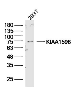 KIAA1598 Rabbit Polyclonal Antibody