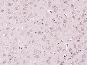 SIRT2 Rabbit Polyclonal Antibody