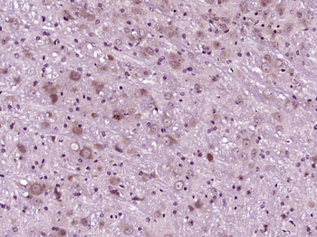 SIRT2 Rabbit Polyclonal Antibody