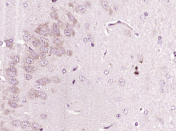 SIRT2 Rabbit Polyclonal Antibody