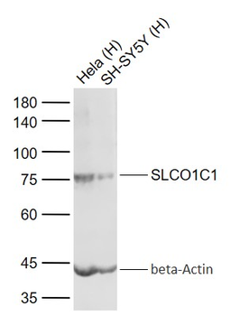 SLCO1C1 Rabbit Polyclonal Antibody