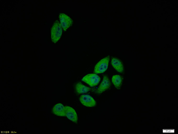 Phospho-Smad3 (Ser423) Rabbit Polyclonal Antibody