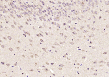 SMUBP2 Rabbit Polyclonal Antibody