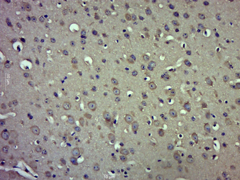 SNX6 Rabbit Polyclonal Antibody