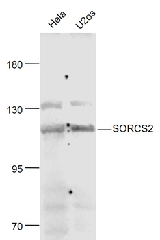 SORCS2 Rabbit Polyclonal Antibody