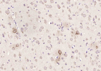 SORCS3 Rabbit Polyclonal Antibody