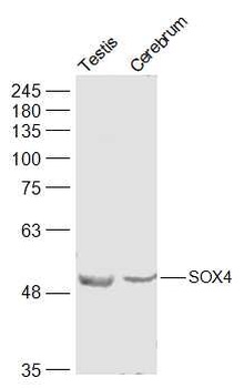 SOX4 antibody