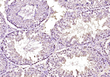 SOX7 Rabbit Polyclonal Antibody