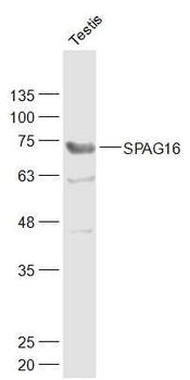 SPAG16 Rabbit Polyclonal Antibody