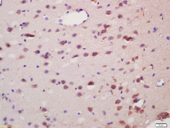 Neurabin 2 Rabbit Polyclonal Antibody