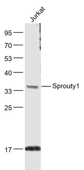 Sprouty1 Rabbit Polyclonal Antibody