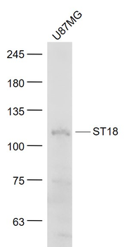 ST18 Rabbit Polyclonal Antibody