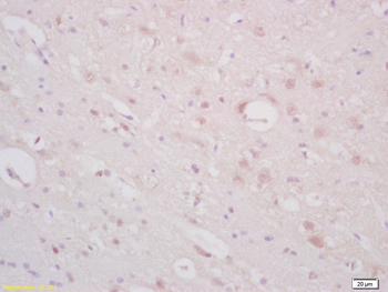 ST18 Rabbit Polyclonal Antibody