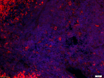 Stabilin 2 Rabbit Polyclonal Antibody