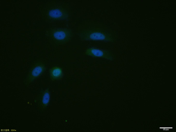 STAT1 Rabbit Polyclonal Antibody