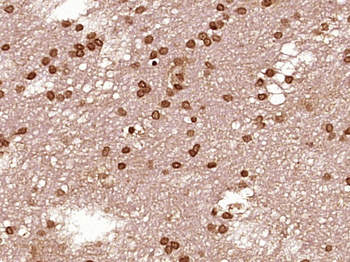STAT1 Rabbit Polyclonal Antibody