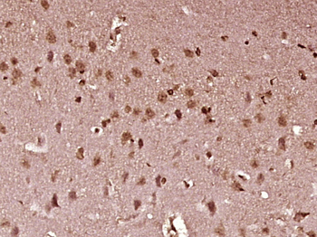 STAT1 Rabbit Polyclonal Antibody