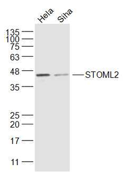 STOML2 Rabbit Polyclonal Antibody