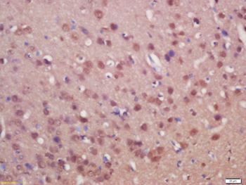 SUFU Rabbit Polyclonal Antibody