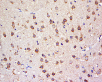 SULT4A1 Rabbit Polyclonal Antibody