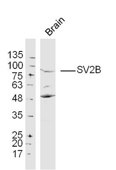 SV2B Rabbit Polyclonal Antibody