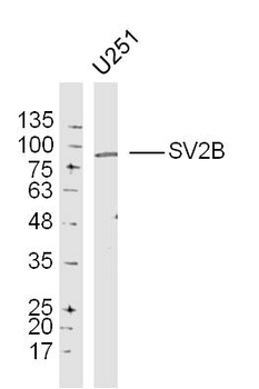 SV2B Rabbit Polyclonal Antibody