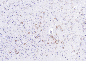 SV2C Rabbit Polyclonal Antibody