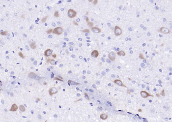 SV2C Rabbit Polyclonal Antibody