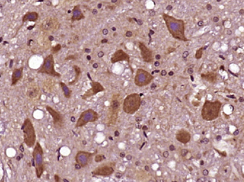 Synaptojanin Rabbit Polyclonal Antibody