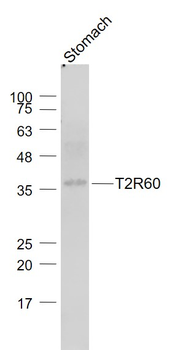 T2R60 Rabbit Polyclonal Antibody