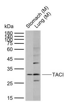 TACI Rabbit Polyclonal Antibody
