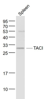 TACI Rabbit Polyclonal Antibody