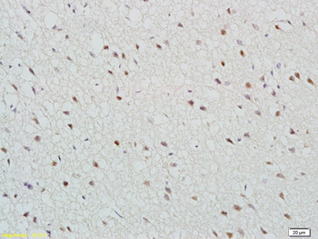 TBR2 Rabbit Polyclonal Antibody