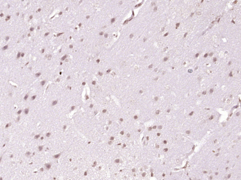 TBX3 Rabbit Polyclonal Antibody