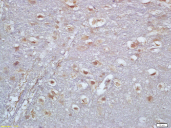 TBX6 Rabbit Polyclonal Antibody