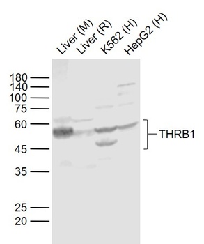 THRB1 antibody