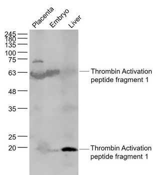 Thrombin Activation peptide fragment 1 Rabbit Polyclonal Antibody
