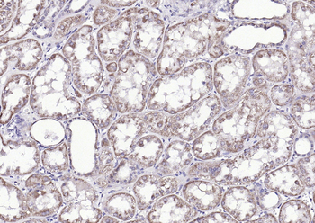 Phospho-TIE2 (Tyr1108) Rabbit Polyclonal Antibody