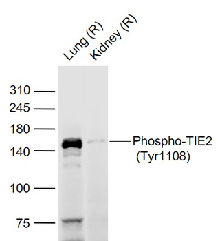 Phospho-TIE2 (Tyr1108) Rabbit Polyclonal Antibody