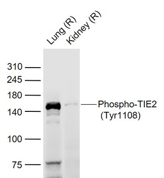 TIE2 (Phospho-Tyr1108) antibody
