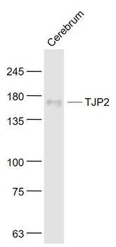 TJP2 Rabbit Polyclonal Antibody