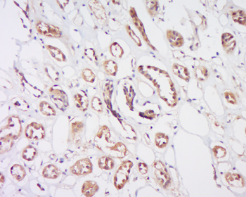 TJP2 Rabbit Polyclonal Antibody