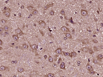 TLR8 Rabbit Polyclonal Antibody