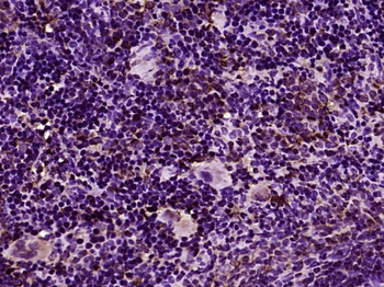 TLR8 Rabbit Polyclonal Antibody