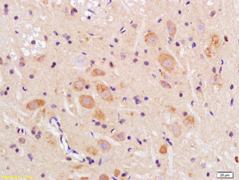 TMEM158 Rabbit Polyclonal Antibody