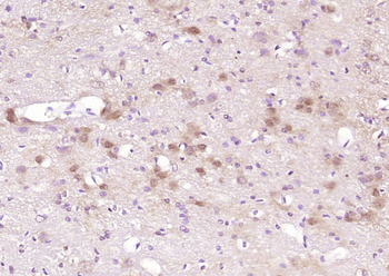 TNIP1 Rabbit Polyclonal Antibody