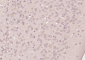 TRA1 variant antibody