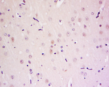 TAGLN3 Rabbit Polyclonal Antibody