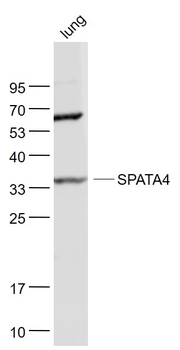 TSARG2/SPATA4 Rabbit Polyclonal Antibody