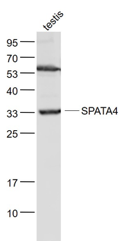 TSARG2/SPATA4 Rabbit Polyclonal Antibody